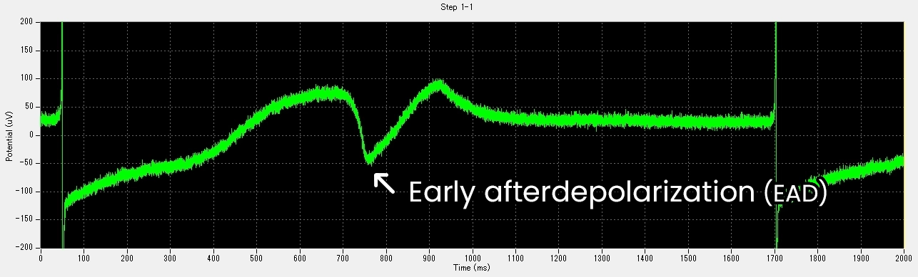 Emergence of EAD-like event (after 30 nM E-4031)